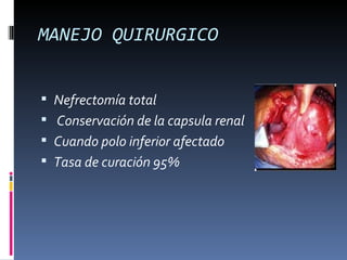 MANEJO QUIRURGICO


 Nefrectomía total
 Conservación de la capsula renal
 Cuando polo inferior afectado
 Tasa de curación 95%
 