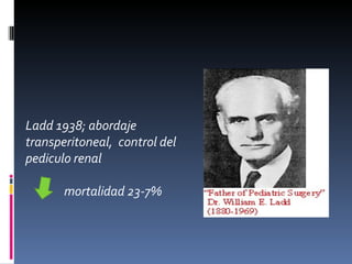 Ladd 1938; abordaje
transperitoneal, control del
pediculo renal

       mortalidad 23-7%
 