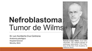 Nefroblastoma
Tumor de Wilms
Dr. Luis Humberto Cruz Contreras
Anatomía patológica
Hospital General
Morelia, Mich
 