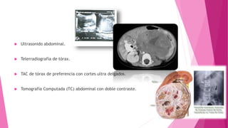  Ultrasonido abdominal.
 Telerradiografía de tórax.
 TAC de tórax de preferencia con cortes ultra delgados.
 Tomografía Computada (TC) abdominal con doble contraste.
 