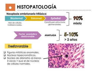 HISTOPATOLOGÍA
Blastemal Estromal Epitelial
Neoplasia embrionaria trifásica:
Islas de células
indiferenciadas.
Constituyen estructuras
glomeruloides. mixto
Factor pronóstico
desfavorable
ANAPLASIA
> 2 años
 Figuras mitóticas anormales.
 Núcleos hipercromáticos.
 Núcleo de diámetro al menos
3 veces > que el de núcleos
de células normales.
 