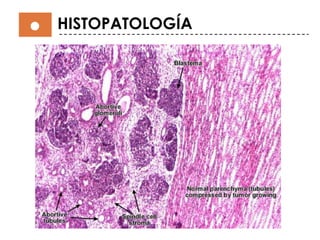 HISTOPATOLOGÍA
 