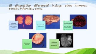 El nefroma
mesoblástico (sobre
todo en recién
nacidos)
El sarcoma de
células claras
El neuroblastoma
(extremadamente
raro en riñones,
pero que puede
afectar al riñón
por continuidad)
Los tumores
rabdoides
Los tumores
estromales
metanéfricos.
El diagnóstico diferencial incluye otros tumores
renales infantiles, como:
 