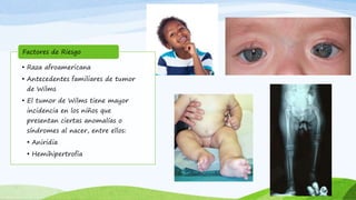 • Raza afroamericana
• Antecedentes familiares de tumor
de Wilms
• El tumor de Wilms tiene mayor
incidencia en los niños que
presentan ciertas anomalías o
síndromes al nacer, entre ellos:
• Aniridia
• Hemihipertrofia
Factores de Riesgo
 