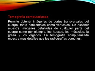 Tomografía computarizada
Permite obtener imágenes de cortes transversales del
cuerpo, tanto horizontales como verticales. Un escáner
muestra imágenes detalladas de cualquier parte del
cuerpo como por ejemplo, los huesos, los músculos, la
grasa y los órganos. La tomografía computarizada
muestra más detalles que las radiografías comunes.
 