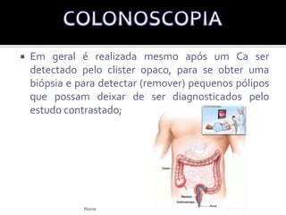 Síndrome autossômica dominante, caracterizada pela combinação de pólipos hamatomatosos do trato intestinal e hiperpigmentação da mucosa bucal dos lábios e dos dígitos;Doença rara e hereditária.Está associada a um aumento no risco de Ca (2-10%) do trato intestinal, estômago até o reto. E também de: mama, ovário cérvice, trompas, tireoide, pulmão, vesícula biliar, ducto biliar, pâncreas, e testículos.Síndrome de Ca Hereditário(Peutz-Jeghers)Nome