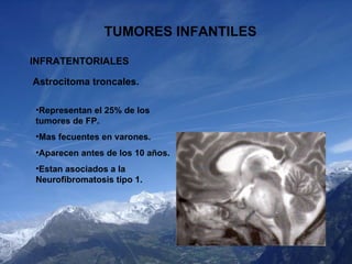 TUMORES INFANTILES INFRATENTORIALES Astrocitoma troncales. <ul><li>Representan el 25 % de los tumores de FP. </li></ul><ul...