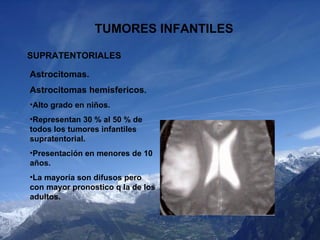 TUMORES INFANTILES SUPRATENTORIALES <ul><li>Astrocitomas. </li></ul><ul><li>Astrocitomas hemisfericos . </li></ul><ul><li>...