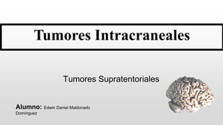 Tumores Intracraneales
Tumores Supratentoriales
Alumno: Edwin Daniel Maldonado
Domínguez
 