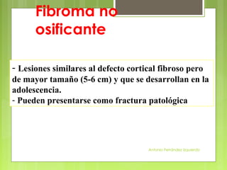 Antonio Ferrández Izquierdo
- Lesiones similares al defecto cortical fibroso pero
de mayor tamaño (5-6 cm) y que se desarrollan en la
adolescencia.
- Pueden presentarse como fractura patológica
Fibroma no
osificante
 