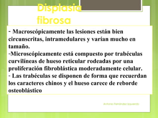 Antonio Ferrández Izquierdo
Displasia
fibrosa
- Macroscópicamente las lesiones están bien
circunscritas, intramedulares y varían mucho en
tamaño.
-Microscópicamente está compuesto por trabéculas
curvilíneas de hueso reticular rodeadas por una
proliferación fibroblástica moderadamente celular.
- Las trabéculas se disponen de forma que recuerdan
los caracteres chinos y el hueso carece de reborde
osteoblástico
 