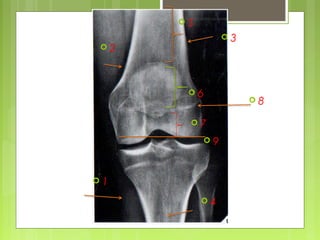  2
 1
 3
 4
 6
 5
 7
 8
 9
 