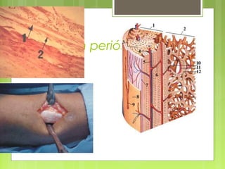 Reacción perióstica
 