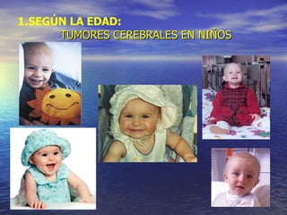 SEGÚN LA EDAD:   TUMORES CEREBRALES EN NIÑOS 