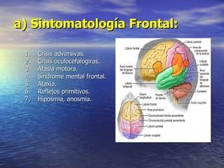 a) Sintomatología Frontal:   Crisis adversivas. Crisis oculocefalogiras. Afasia motora. Síndrome mental frontal. 5.  Ataxia. 6.  Reflejos primitivos. Hiposmia, anosmia. 
