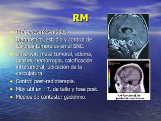 RM Imágenes más nítidas. Diagnóstico, estudio y control de lesiones tumorales en el SNC. Observar: masa tumoral, edema, quistes, hemorragia, calcificación intratumoral, ubicación de la vasculatura. Control post-radioterapia. Muy útil en : T. de tallo y fosa post. Medios de contaste: gadolinio. 