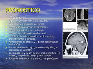 PRONOSTICO El tipo de tumor. Qué tan avanzada está la enfermedad. El tamaño y la ubicación del tumor. La presencia o ausencia de metástasis. La respuesta del tumor a la terapia. La edad y el estado de salud general. La tolerancia a determinados medicamentos, procedimientos o terapias.  Astrocitomas de grado I y II tienen sobrevida de varios años. Los atrocitomas de bajo grado de malignidad, el pronostico es variable. Los grados III y IV son de muy mal pronóstico (12 meses), después de cirugía y radioterapia. Pacientes con metástasis al SNC, mal pronóstico. 