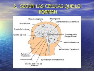 2.  SEGÚN LAS CELULAS QUE LO FORMAN   
