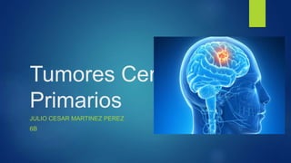 Tumores Cerebrales
Primarios
JULIO CESAR MARTINEZ PEREZ
6B
 