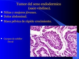 Tumor del seno endodermico  (saco vitelino). Niñas y mujeres jóvenes. Dolor abdominal. Masa pélvica de rápido   crecimiento. Cuerpos de schiller Duval 