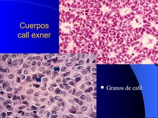 Granos de café Cuerpos call exner 