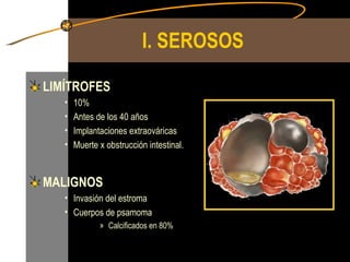 I. SEROSOS LIMÍTROFES 10% Antes de los 40 años Implantaciones extraováricas Muerte x obstrucción intestinal. MALIGNOS Invasión del estroma Cuerpos de psamoma Calcificados en 80% 