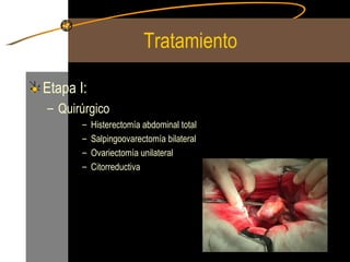 Tratamiento  Etapa I: Quirúrgico  Histerectomía abdominal total Salpingoovarectomía bilateral Ovariectomía unilateral Citorreductiva 