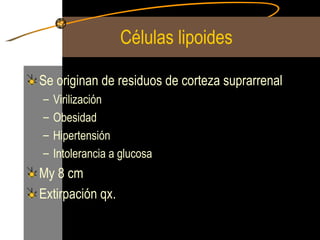 Células lipoides Se originan de residuos de corteza suprarrenal Virilización Obesidad Hipertensión Intolerancia a glucosa My 8 cm Extirpación qx. 