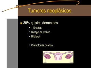 Tumores neoplásicos  80% quistes dermoides - 40 años  Riesgo de torsión Bilateral Cistectomía ovárica 