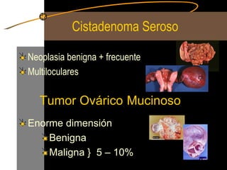 Cistadenoma Seroso Neoplasia benigna + frecuente Multiloculares Tumor Ovárico   Mucinoso Enorme dimensión Benigna  Maligna }  5 – 10% 