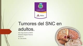 Tumores del SNC en
adultos.
Elier Vega Gutiérrez 259791
Elizabeth Delgado Palacios
Grupo 8-1
Dr. Julio Dávila
 