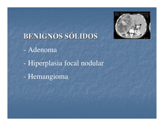 Tumores Hepaticos