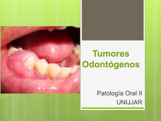 Tumores
Odontógenos
Patología Oral II
UNIJJAR
 