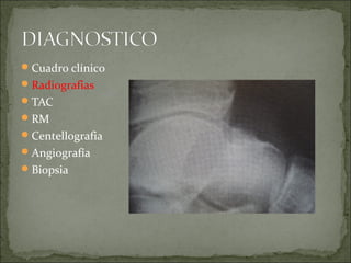 Cuadro clínico
Radiografias
TAC
RM
Centellografia
Angiografía
Biopsia
 