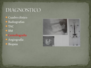Cuadro clínico
Radiografias
TAC
RM
Centellografia
Angiografía
Biopsia
 