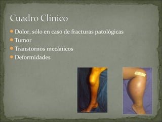 Dolor, sólo en caso de fracturas patológicas
Tumor
Transtornos mecánicos
Deformidades
 