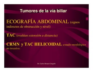 Tumores Vía Biliar