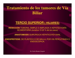 Tumores Vía Biliar