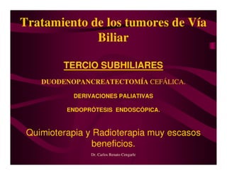 Tumores Vía Biliar