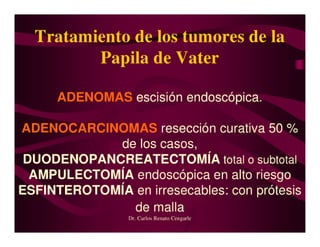 Tumores Vía Biliar