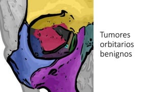 Tumores
orbitarios
benignos
 