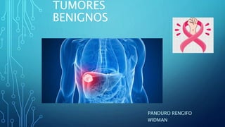 TUMORES
BENIGNOS
PANDURO RENGIFO
WIDMAN
 
