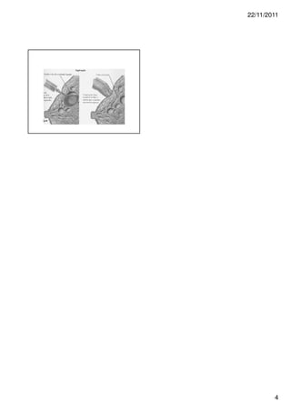 22/11/2011




        4
 