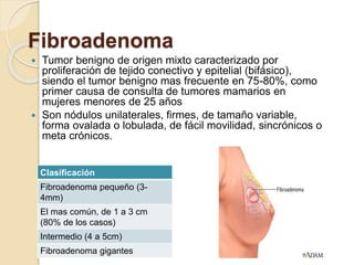 Fibroadenoma
 Tumor benigno de origen mixto caracterizado por
proliferación de tejido conectivo y epitelial (bifásico),
siendo el tumor benigno mas frecuente en 75-80%, como
primer causa de consulta de tumores mamarios en
mujeres menores de 25 años
 Son nódulos unilaterales, firmes, de tamaño variable,
forma ovalada o lobulada, de fácil movilidad, sincrónicos o
meta crónicos.
Clasificación
Fibroadenoma pequeño (3-
4mm)
El mas común, de 1 a 3 cm
(80% de los casos)
Intermedio (4 a 5cm)
Fibroadenoma gigantes
 