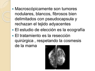  Macroscópicamente son tumores
nodulares, blancos, fibrosos bien
delimitados con pseudocapsula y
rechazan el tejido adyacentes
 El estudio de elección es la ecografía
 El tratamiento es la resección
quirúrgica , respetando la cosmesis
de la mama
 