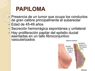 PAPILOMA
 Presencia de un tumor que ocupa los conductos
de gran calibre principalmente el subareolar
 Edad de 45-49 años
 Secreción hemorrágica espontanea y unilateral
 Hay proliferación papilar del epitelio ductal
asentadas en un tallo fibroconjuntivo
vascularizados
 
