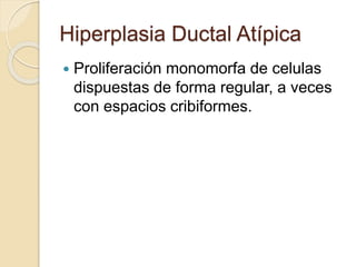 Hiperplasia Ductal Atípica
 Proliferación monomorfa de celulas
dispuestas de forma regular, a veces
con espacios cribiformes.
 