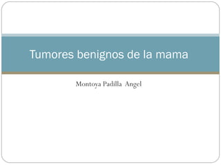 Montoya Padilla  Angel Tumores benignos de la mama  