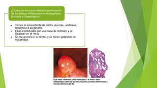 • Tienen el antecedente de colitis ulcerosa, amibiana,
isquémica o parasitaria
• Están constituidos por una masa de linfoides y se
localizan en el recto
• Se encuentran en el recto, y no tienen potencial de
malignidad.
¿Cuáles son las características particulares
de los pólipos inflamatorio o seudopolipos,
linfoides e hiperplásicos?
 