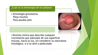 • Etimología grecolatina
Polys-muchos
Pous poudos-pies
¿Cuál es la etimología de los pólipos?
•Termino clínico que describe cualquier
crecimiento que sobresale de una superficie
mucosa, hacia su luz, sin considerar su naturaleza
histológica, o si es sésil o pediculado
 